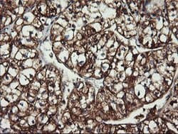 ACAA2 Monoclonal Antibody (OTI1D3), TrueMAB , OriGene:Antibodies:Primary