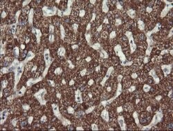 ACAA2 Monoclonal Antibody (OTI1D3), TrueMAB , OriGene 100 &mu;L; Unconjugated:Antibodies,