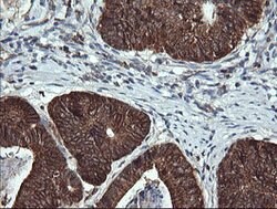 ACAA2 Mouse anti-Canine, Human, Mouse, Rat, Clone: OTI2F6, lyophilized,