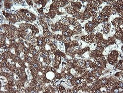 ACAA2 Mouse anti-Canine, Human, Mouse, Rat, Clone: OTI2F6, lyophilized,