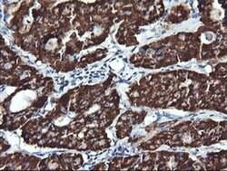 ACAA2 Monoclonal Antibody (OTI2H2), TrueMAB , OriGene 100 &mu;L; Unconjugated:Antibodies,