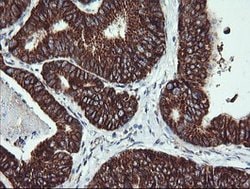ACAA2 Mouse anti-Canine, Human, Mouse, Rat, Clone: OTI2G6, lyophilized,