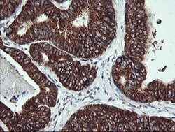 ACAA2 Monoclonal Antibody (OTI2G6), TrueMAB , OriGene 100 &mu;L; Unconjugated:Antibodies,