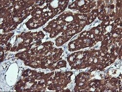 ACAA2 Monoclonal Antibody (OTI2G6), TrueMAB , OriGene 100 &mu;L; Unconjugated:Antibodies,