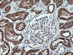 ACAA2 Monoclonal Antibody (OTI2G6), TrueMAB , OriGene:Antibodies:Primary