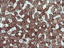 ACAA2 Monoclonal Antibody (OTI2G6), TrueMAB , OriGene:Antibodies:Primary