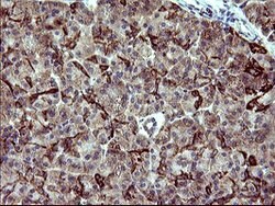 ACAA2 Mouse anti-Human, Clone: OTI3H9, lyophilized, TrueMAB 100 &mu;g;