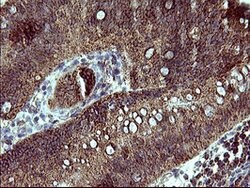 ACAA2 Mouse anti-Human, Clone: OTI3H9, lyophilized, TrueMAB 100 &mu;g;