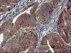 ACAA2 Mouse anti-Human, Clone: OTI3H9, lyophilized, TrueMAB 100 &mu;g;