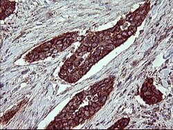 ACAA2 Mouse anti-Human, Clone: OTI3H9, lyophilized, TrueMAB 100 &mu;g;