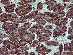 ACAA2 Mouse anti-Human, Clone: OTI3H9, lyophilized, TrueMAB 100 &mu;g;