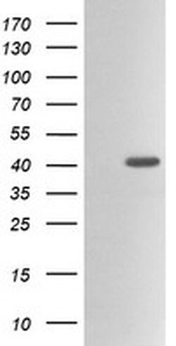 ACAA2 Monoclonal Antibody (OTI1D3), TrueMAB , OriGene 100 &mu;L; Unconjugated:Antibodies,