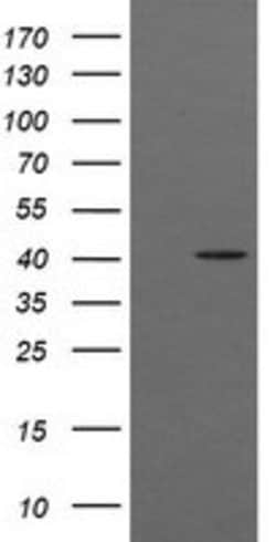 ACAA2 Mouse anti-Canine, Human, Mouse, Rat, Clone: OTI1C10, lyophilized,