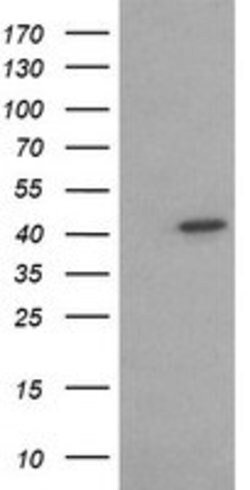 ACAA2 Mouse anti-Canine, Human, Mouse, Rat, Clone: OTI2F6, lyophilized,