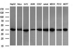 ACAA2 Mouse anti-Canine, Human, Mouse, Rat, Clone: OTI2F6, lyophilized,