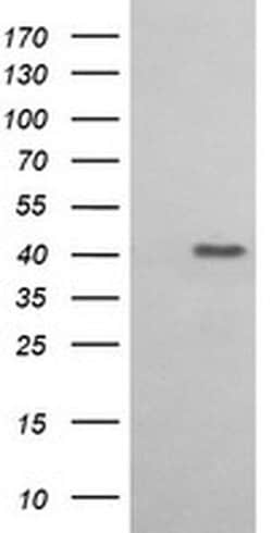 ACAA2 Monoclonal Antibody (OTI2H2), TrueMAB , OriGene 100 &mu;L; Unconjugated:Antibodies,