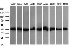 ACAA2 Monoclonal Antibody (OTI2H2), TrueMAB , OriGene 100 &mu;L; Unconjugated:Antibodies,