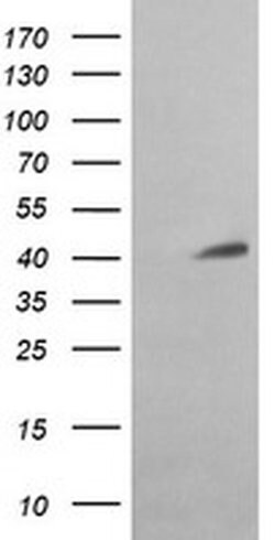ACAA2 Monoclonal Antibody (OTI2G6), TrueMAB , OriGene 100 &mu;L; Unconjugated:Antibodies,