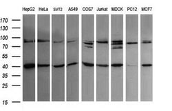 ACAA2 Mouse anti-Canine, Human, Mouse, Rat, Clone: OTI2G6, lyophilized,