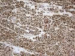ACADM Monoclonal Antibody (OTI2G7), TrueMAB , OriGene 100 &mu;L; Unconjugated:Antibodies,