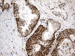 ACADM Monoclonal Antibody (OTI2G7), TrueMAB , OriGene 100 &mu;L; Unconjugated:Antibodies,