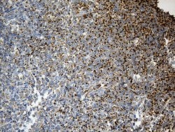 ACADM Monoclonal Antibody (OTI2G7), TrueMAB , OriGene:Antibodies:Primary