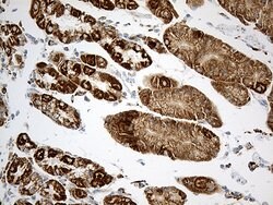 ACADM Monoclonal Antibody (OTI2G7), TrueMAB , OriGene 100 &mu;L; Unconjugated:Antibodies,
