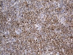 ACADM Monoclonal Antibody (OTI2G7), TrueMAB , OriGene:Antibodies:Primary