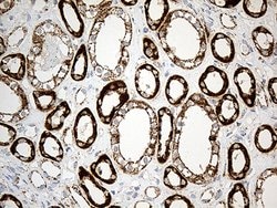 ACADM Monoclonal Antibody (OTI2G7), TrueMAB , OriGene 100 &mu;L; Unconjugated:Antibodies,