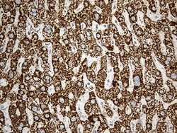ACADM Monoclonal Antibody (OTI2G7), TrueMAB , OriGene 100 &mu;L; Unconjugated:Antibodies,