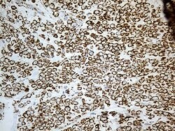 ACADM Monoclonal Antibody (OTI10A5), TrueMAB , OriGene 100 &mu;L; Unconjugated:Antibodies,