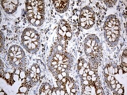 ACADM Monoclonal Antibody (OTI10A5), TrueMAB , OriGene 100 &mu;L; Unconjugated:Antibodies,