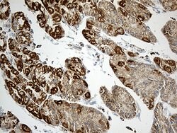 ACADM Monoclonal Antibody (OTI10A5), TrueMAB , OriGene 100 &mu;L; Unconjugated:Antibodies,