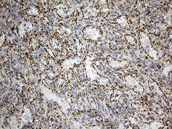 ACADM Monoclonal Antibody (OTI10A5), TrueMAB , OriGene 100 &mu;L; Unconjugated:Antibodies,