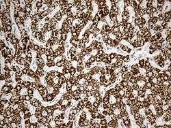 ACADM Monoclonal Antibody (OTI10A5), TrueMAB , OriGene 100 &mu;L; Unconjugated:Antibodies,