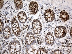 ACADM Monoclonal Antibody (OTI9G10), TrueMAB , OriGene 100 &mu;L; Unconjugated:Antibodies,