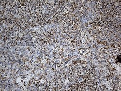 ACADM Monoclonal Antibody (OTI9G10), TrueMAB , OriGene 100 &mu;L; Unconjugated:Antibodies,