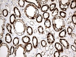 ACADM Mouse anti-Human, Clone: OTI9G10, lyophilized, TrueMAB 100 &mu;g;