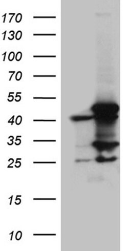 ACADM Monoclonal Antibody (OTI2G7), TrueMAB , OriGene 100 &mu;L; Unconjugated:Antibodies,