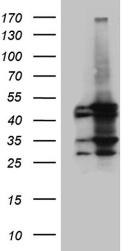 ACADM Monoclonal Antibody (OTI10A5), TrueMAB , OriGene 100 &mu;L; Unconjugated:Antibodies,