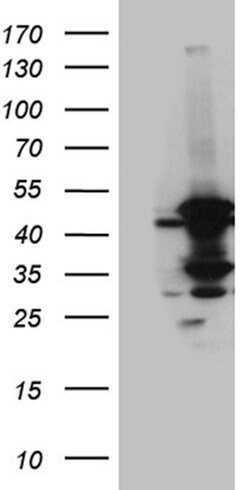 ACADM Mouse anti-Human, Clone: OTI9G10, lyophilized, TrueMAB 100 &mu;g;
