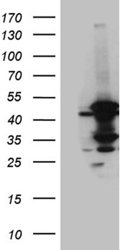 ACADM Monoclonal Antibody (OTI9G10), TrueMAB , OriGene 100 &mu;L; Unconjugated:Antibodies,