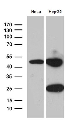 ACADM Monoclonal Antibody (OTI9G10), TrueMAB , OriGene 100 &mu;L; Unconjugated:Antibodies,