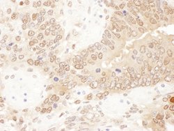 ACAT2 Rabbit anti-Human, Mouse, Polyclonal, Bethyl Laboratories 100 &mu;L | Buy Online | Bethyl Laboratories, Inc | Fisher Scientific