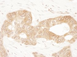 ACAT2 Rabbit anti-Human, Mouse, Polyclonal, Bethyl Laboratories 100 &mu;L | Buy Online | Bethyl Laboratories, Inc | Fisher Scientific