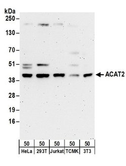 ACAT2 Rabbit anti-Human, Mouse, Polyclonal, Bethyl Laboratories 100 &mu;L | Buy Online | Bethyl Laboratories, Inc | Fisher Scientific