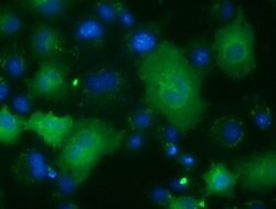 ACAT2 Mouse anti-Canine, Human, Rat, Clone: OTI1C5, lyophilized, TrueMAB