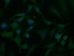 ACAT2 Mouse anti-Canine, Human, Rat, Clone: OTI1C5, lyophilized, TrueMAB