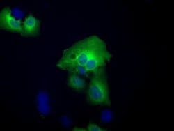 ACAT2 Monoclonal Antibody (OTI5F7), TrueMAB , OriGene 30 &mu;L; Unconjugated:Antibodies,