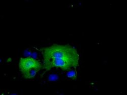 ACAT2 Monoclonal Antibody (OTI1G6), TrueMAB , OriGene 30 &mu;L; Unconjugated:Antibodies,
